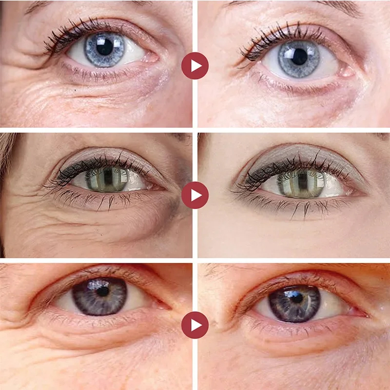 Wrinkle Remove Eyes Patches Fi - огляд і ціна Sheet Mask Collagen